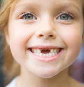 Child's loose tooth