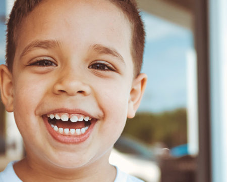 What are Dental Sealants and Does My Child Need Them?