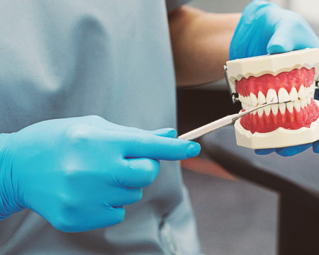 Everything You Need to Know About a Cavity