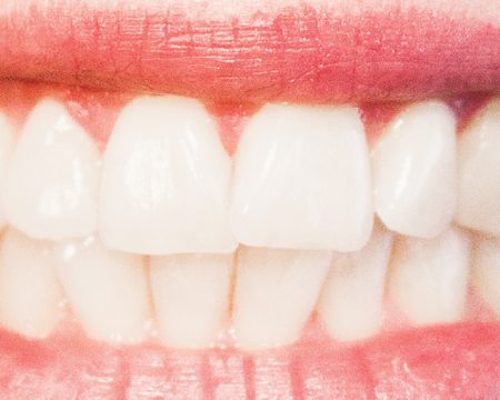 Everything You Need to Know About Tooth Enamel