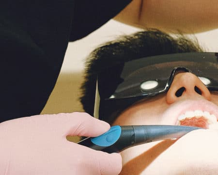 Are Children's Dental Sealants Safe and Worth the Investment?