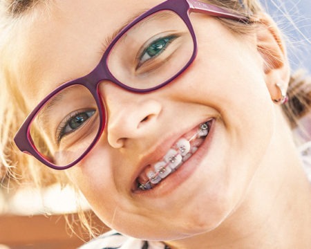 How to Teach Kids with Braces Dental Hygiene