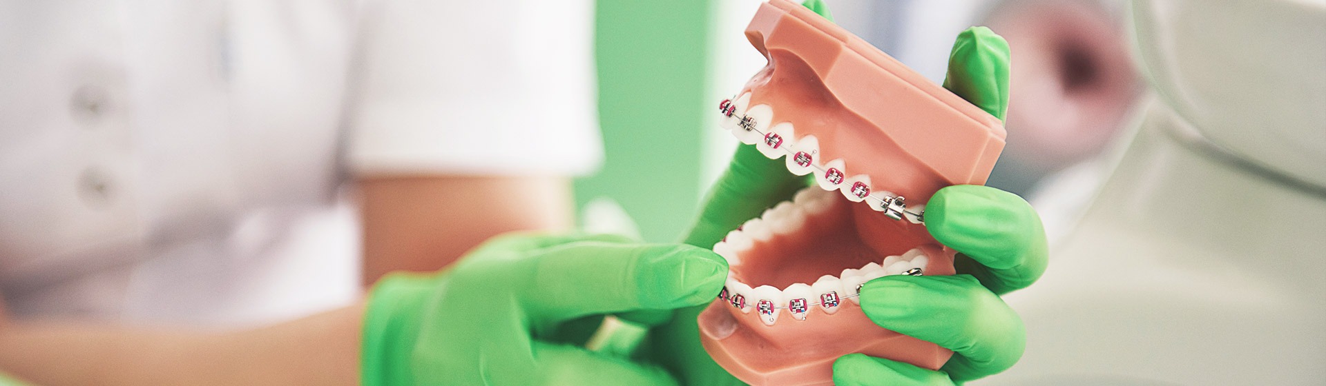 How Braces Work to Straighten Your Child's Teeth?